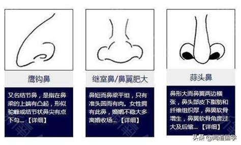 鼻子看相|鼻相分析10款｜鼻樑有節及橫紋、豬膽鼻、鼻頭下垂代 